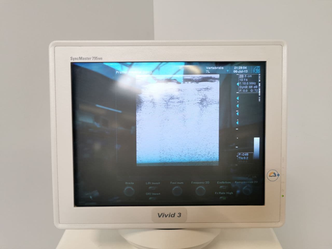 GE Healthcare 7L Linear Ultrasound Probe thumbnail 7