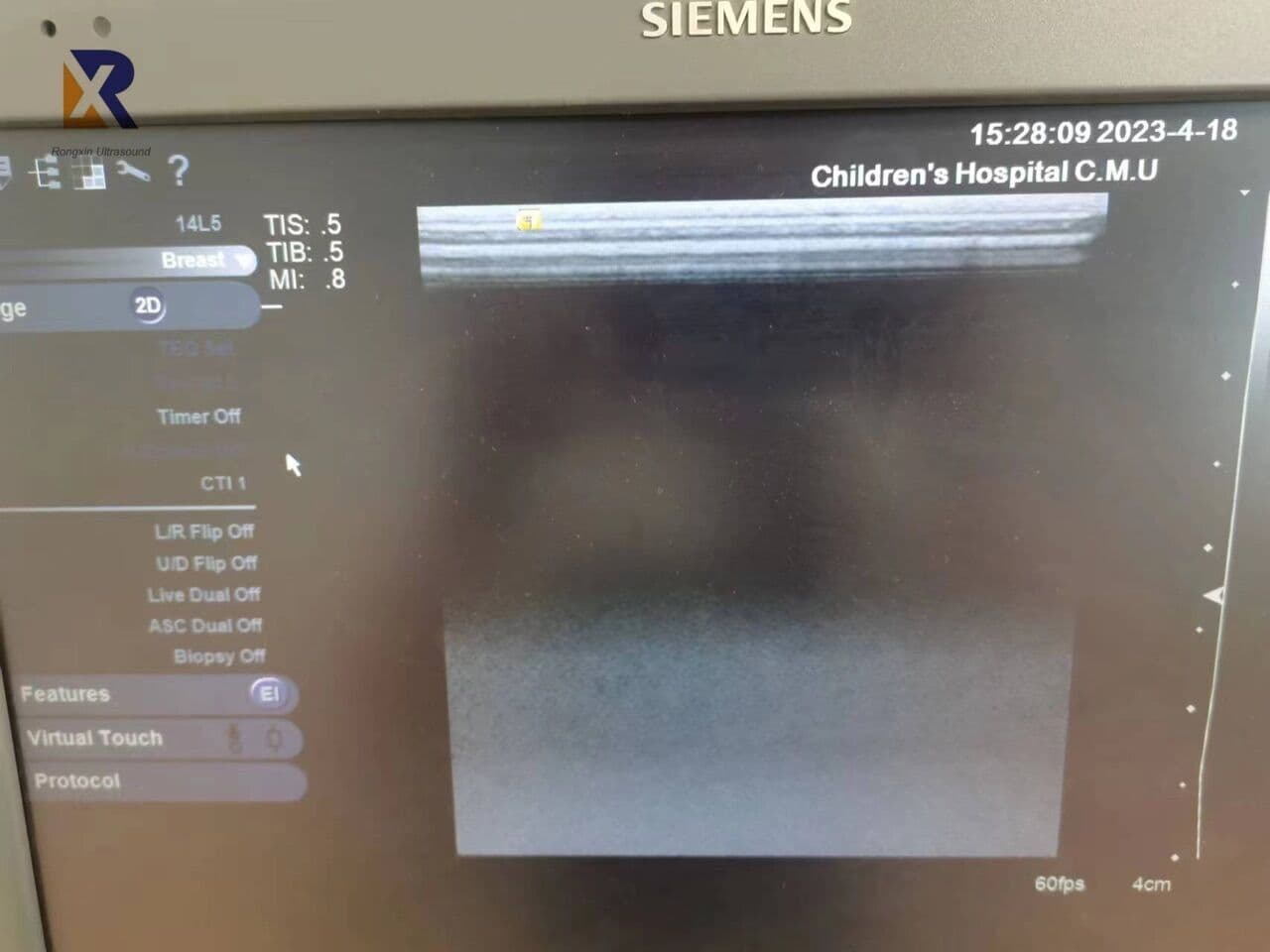 Siemens 14L5 (S2000) Linear Array Ultrasound Transducer thumbnail 4