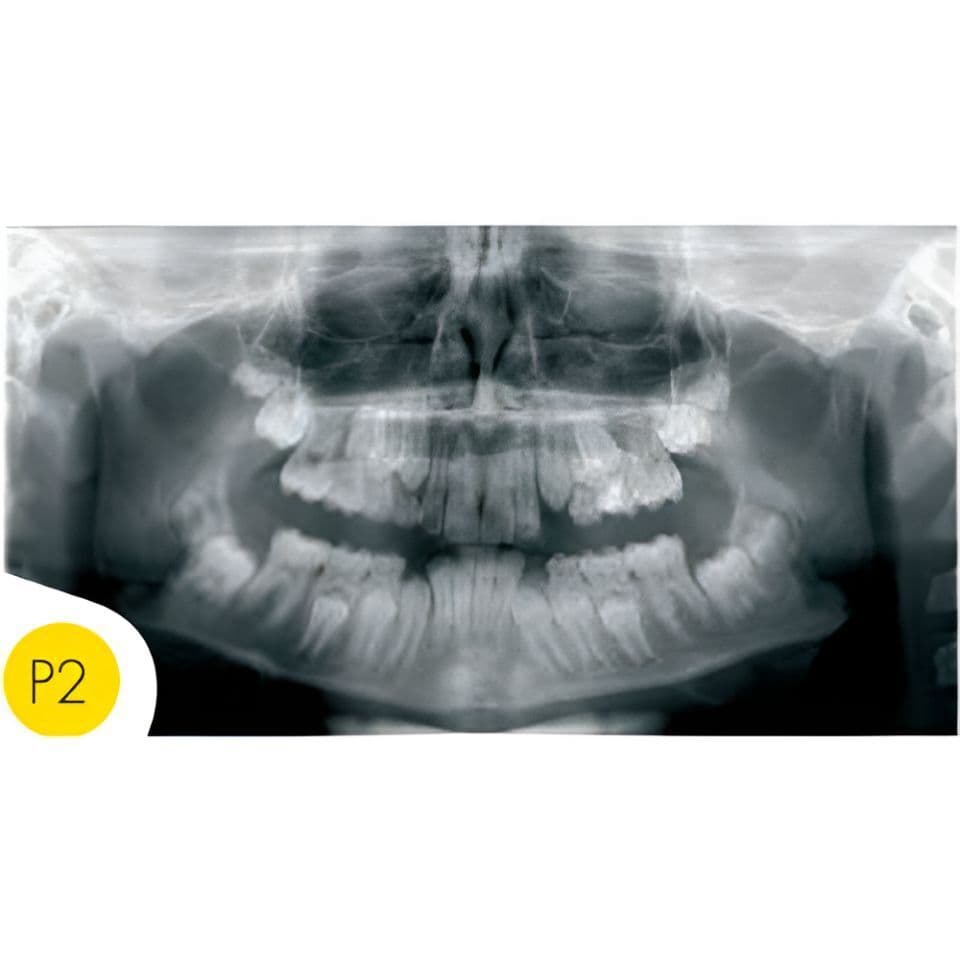 Instrumentarium OP30-2 Pan Digital Panoramic Dental X-Ray thumbnail 5