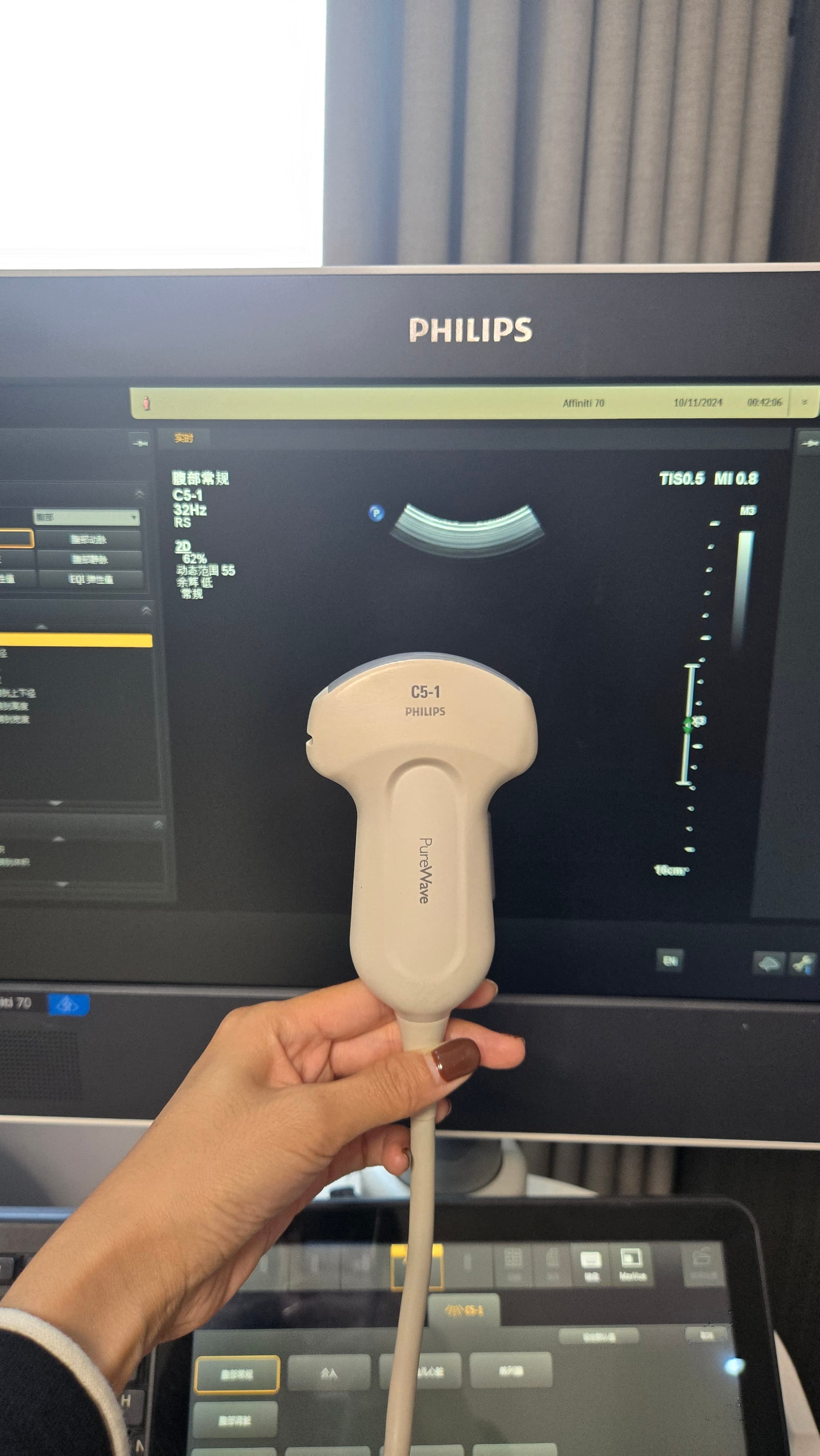 Philips Compact C5-1 PureWave Convex Ultrasound Probe for CX50 and Sparq Systems – Abdominal, OB/GYN and General Imaging