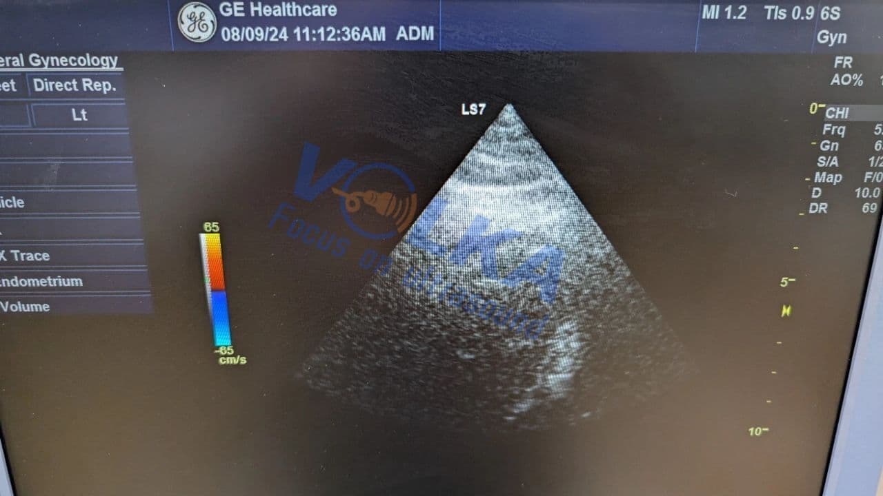 GE Healthcare 6S-D Ultrasound Transducer thumbnail 2
