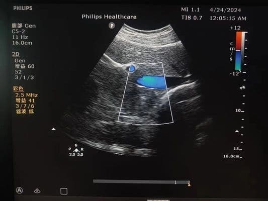 Philips C5-2 Convex Array Ultrasound Probe image 1