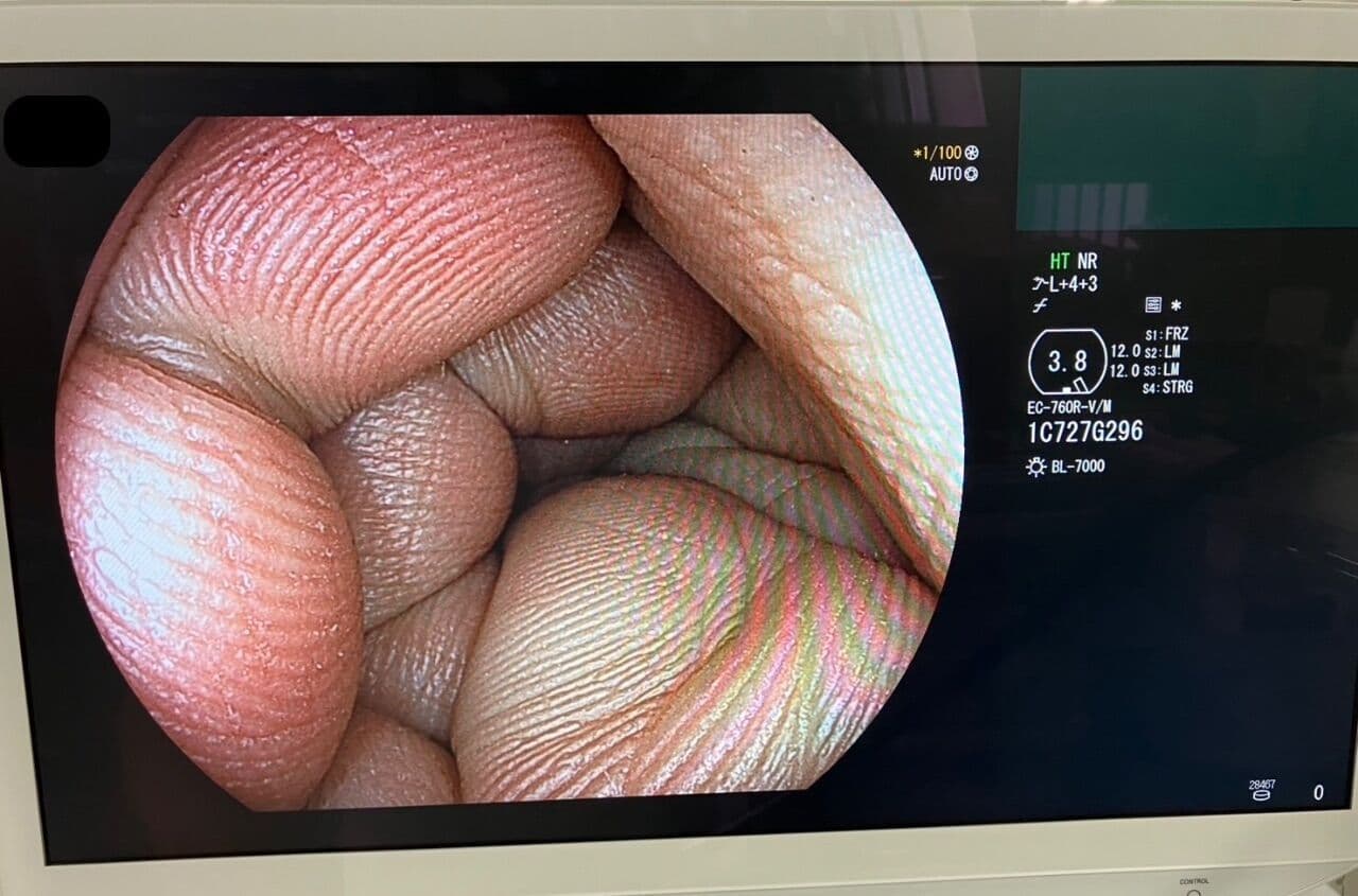 Complete Fujinon Eluxeo 7000 Video Endoscopy System thumbnail 5