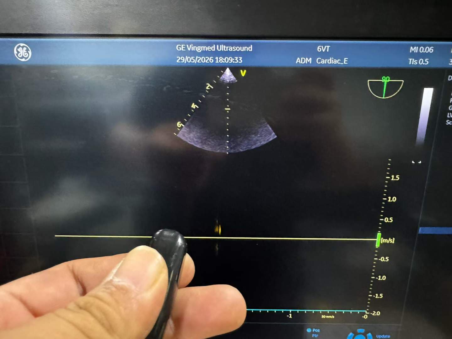 GE 6VT-D 4D TEE Matrix Array Ultrasound Probe for Vivid E9, E95 & Cardiac Systems thumbnail 2