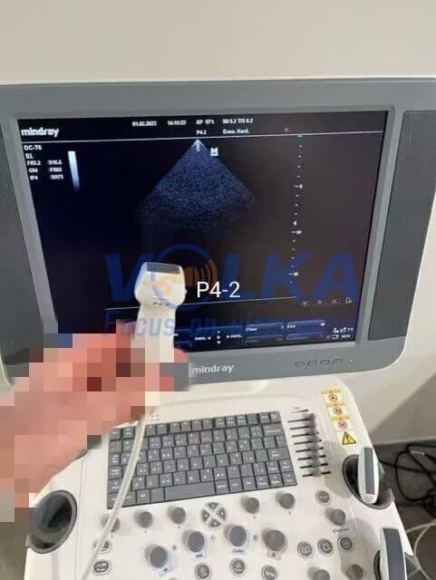 Mindray P4-2 Phased Array Ultrasound Transducer image 1