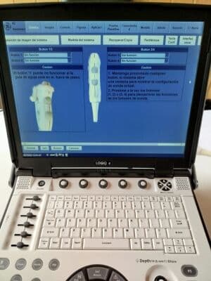 GE Logiq E Portable Ultrasound System thumbnail 5