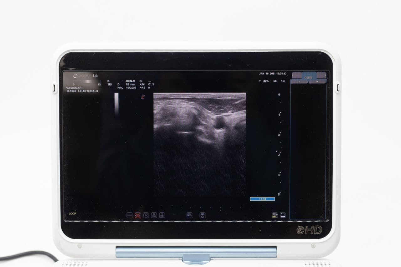 Esaote MyLab Alpha Portable Ultrasound System thumbnail 13