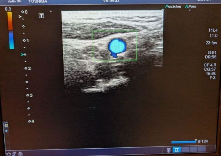 Toshiba PLT-704SBT Linear Ultrasound Transducer for Aplio, Xario, and Artida Systems thumbnail 7