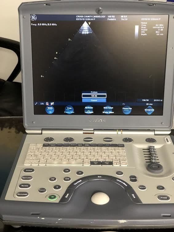 GE 10S-RS Sector Array Ultrasound Transducer thumbnail 2