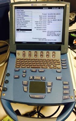 SonoSite MicroMaxx Portable OB/GYN and Vascular Ultrasound System image 1