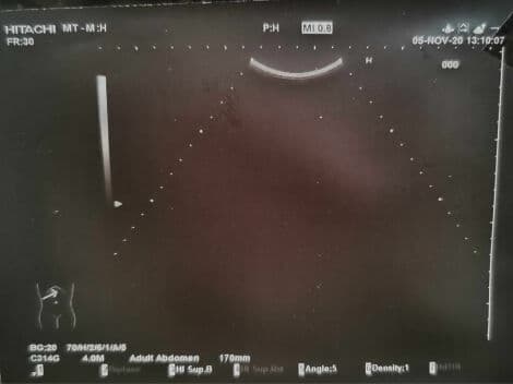 Hitachi EUP-C314G Convex Ultrasound Transducer thumbnail 2