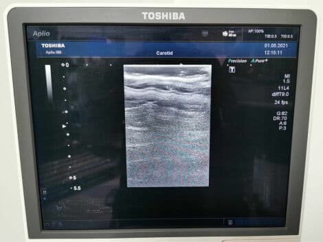 Linear Ultrasound Transducer — Toshiba PLT-704SBT thumbnail 6