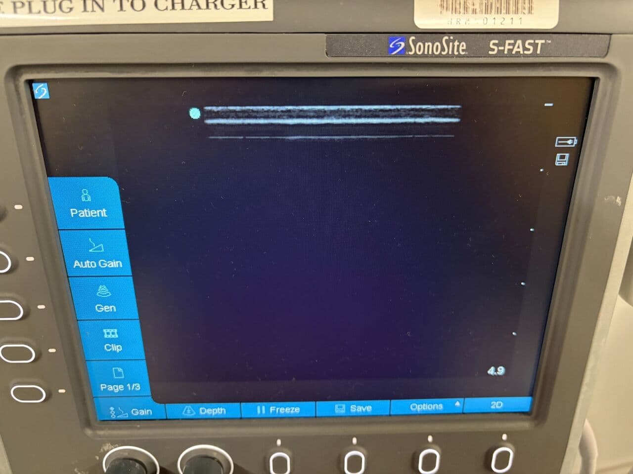 Sonosite P07578 S-FAST Ultrasound System thumbnail 3