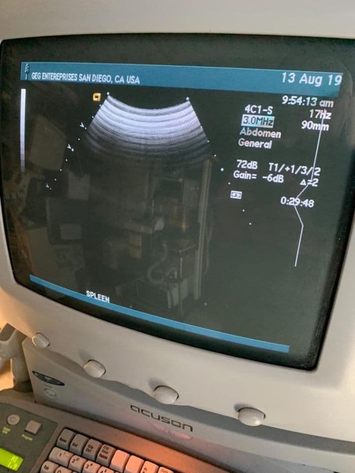 Abdominal and General Purpose Imaging with the Acuson 4C1 Convex Ultrasound Transducer thumbnail 5