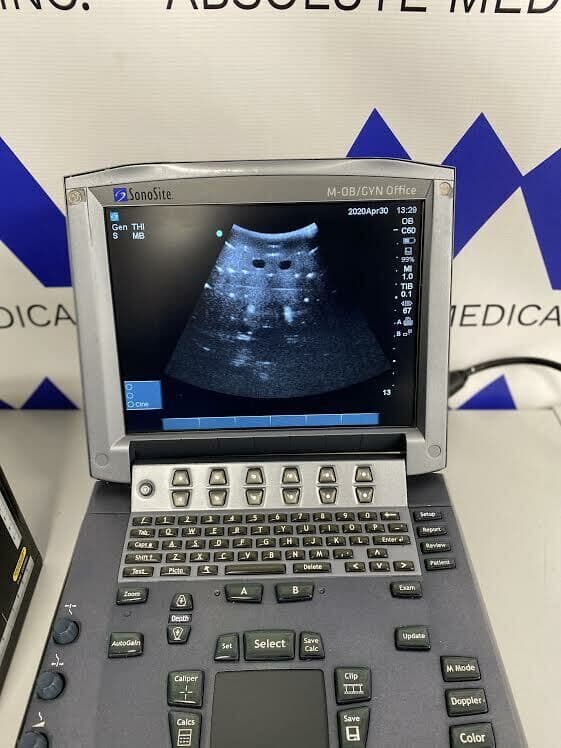 SonoSite M-Turbo Portable Digital Ultrasound System thumbnail 5