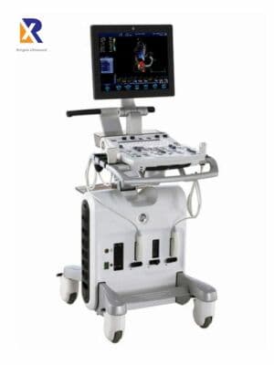 GE Logiq S6 General Imaging Ultrasound System image 1