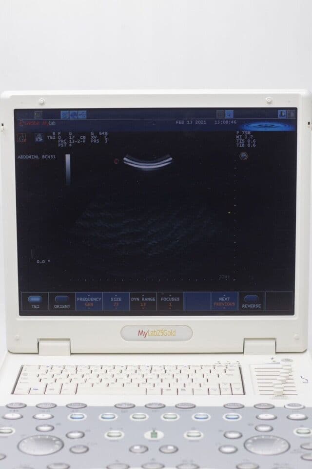 Esaote MyLab 30 Ultrasound System with 3D Abdominal Probe thumbnail 2