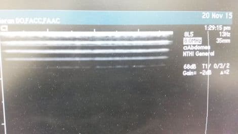 Acuson 8L5 Linear Array Ultrasound Transducer thumbnail 3