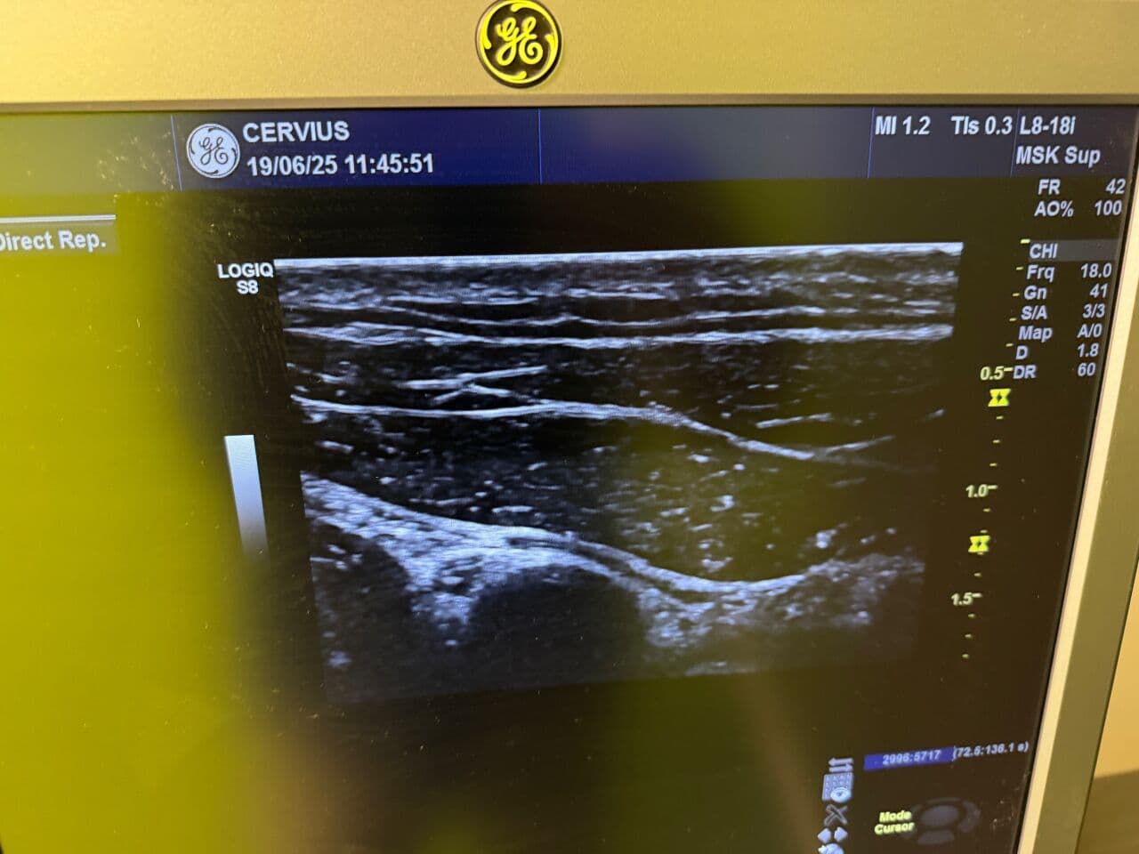 GE L8-18i-D Linear Array Ultrasound Probe thumbnail 3