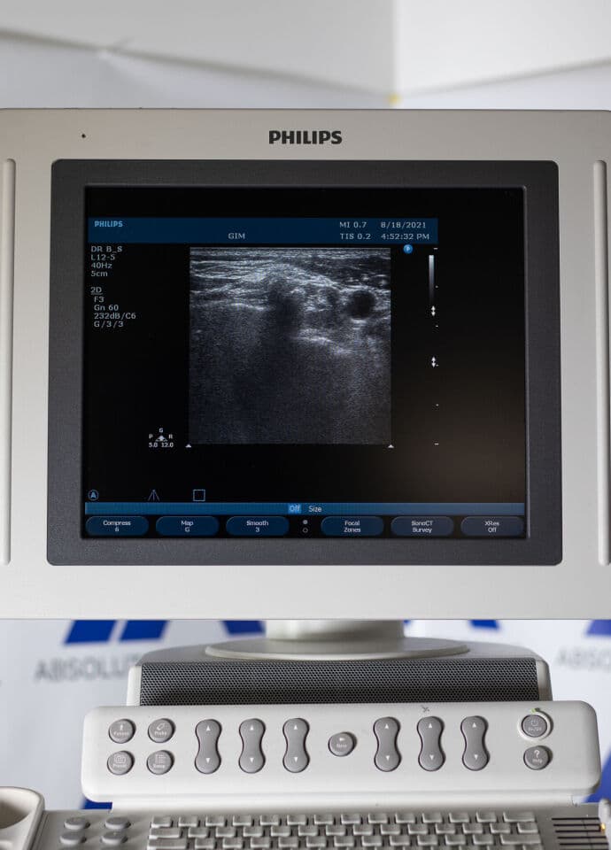 Philips HD11xe Ultrasound System thumbnail 11