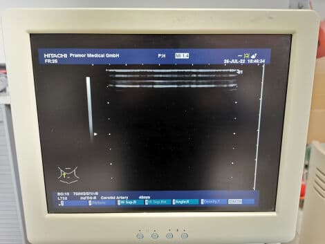 Hitachi EUP-L73S Linear Array Ultrasound Transducer thumbnail 7