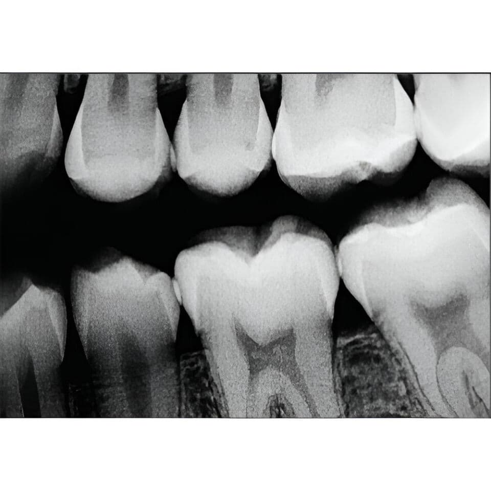 Schick CDR Elite Size 2 Digital Dental Sensors thumbnail 7