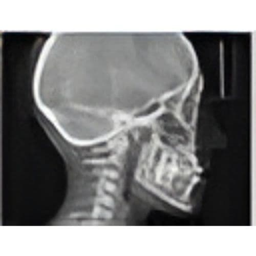 Sirona Orthophos XG Pan + Ceph Dental X-Ray System thumbnail 3