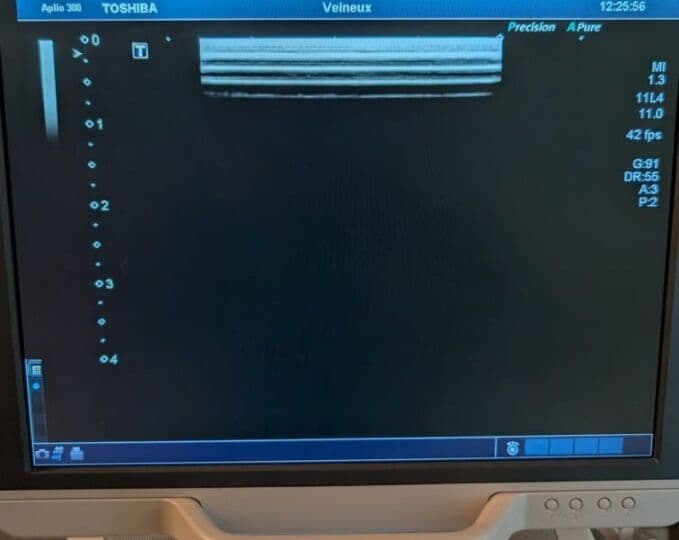 Toshiba PLT-704SBT Linear Ultrasound Transducer for Aplio, Xario, and Artida Systems thumbnail 6
