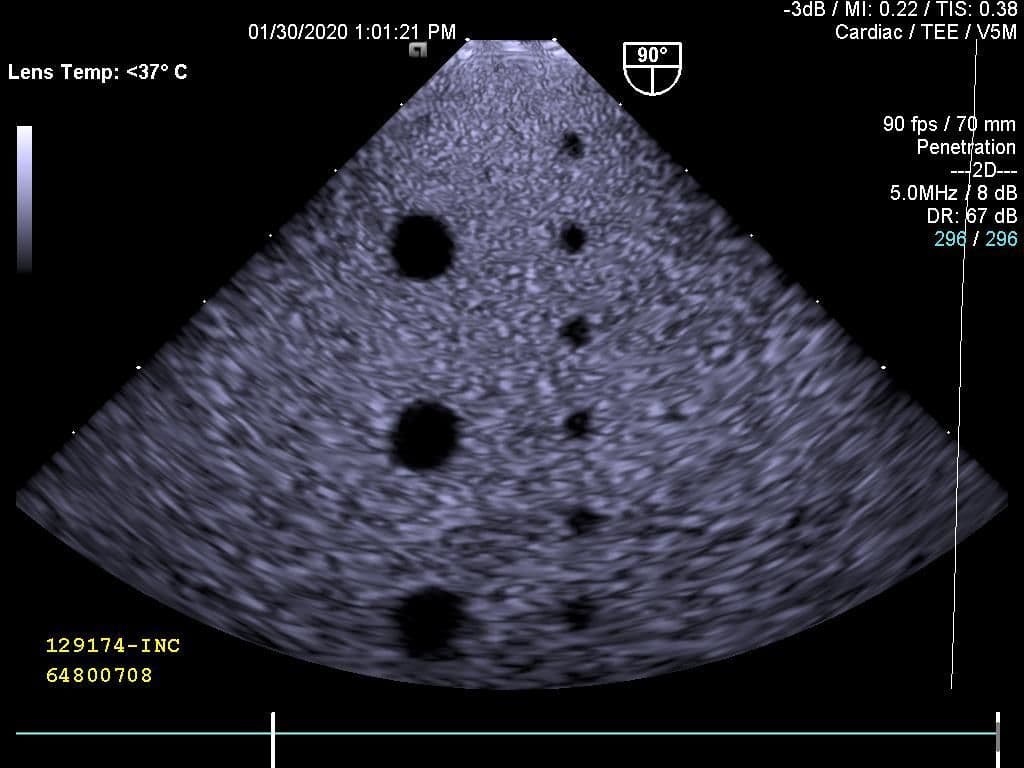 Siemens V5M Cardiac Ultrasound Transducer thumbnail 4