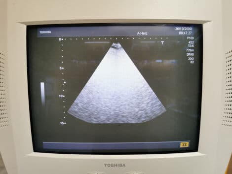 Toshiba PSM-25AT Cardiac Ultrasound Transducer thumbnail 2
