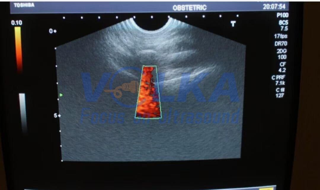 Toshiba PVM-740RT Ultrasound Probe thumbnail 3
