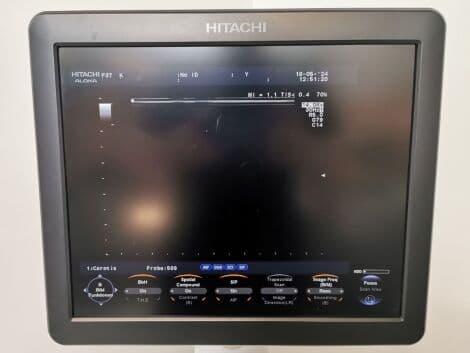 Hitachi Aloka F-37 Ultrasound System with UST-9123, UST-568, and UST-9124 Probes thumbnail 5