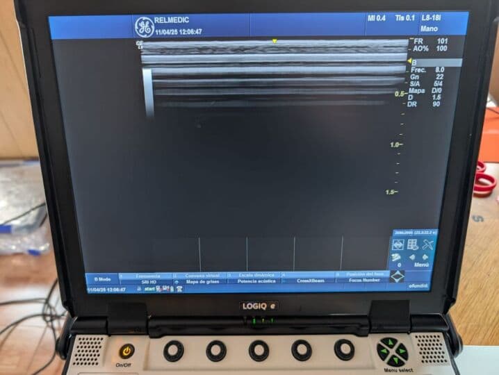 GE L8-18i-RS Intraoperative Stick Ultrasound Transducer thumbnail 6