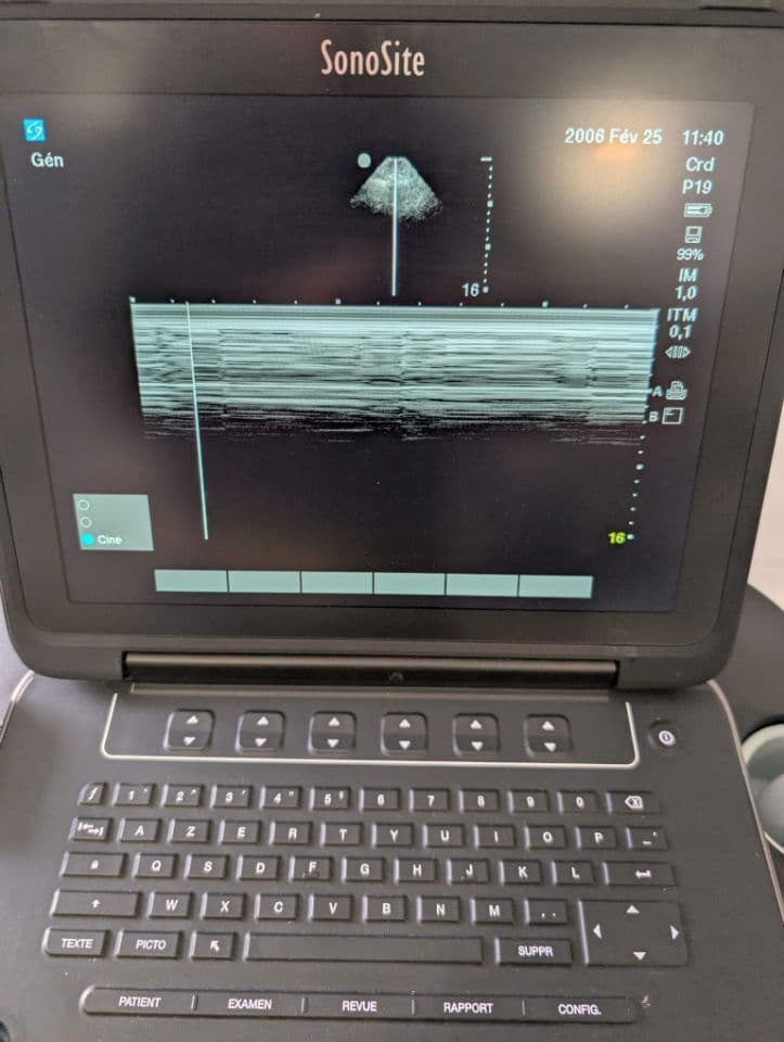 Sonosite rP19x Cardiac Ultrasound Transducer Probe thumbnail 9