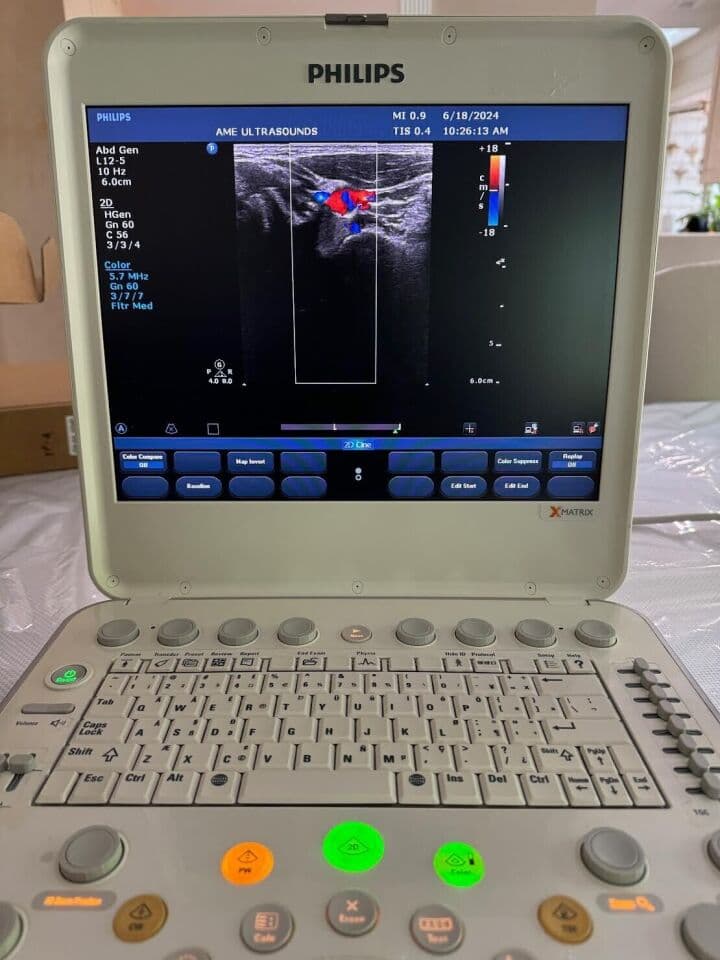 Philips CX50 Portable Cardiac Ultrasound System thumbnail 4