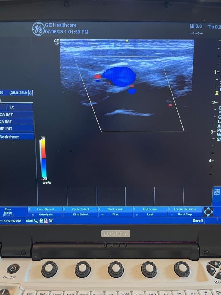 GE 9L-RS Linear Array Ultrasound Probe thumbnail 3
