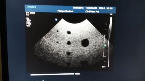 Philips C8-5 Curved Array Ultrasound Transducer for Neonatal Imaging thumbnail 4