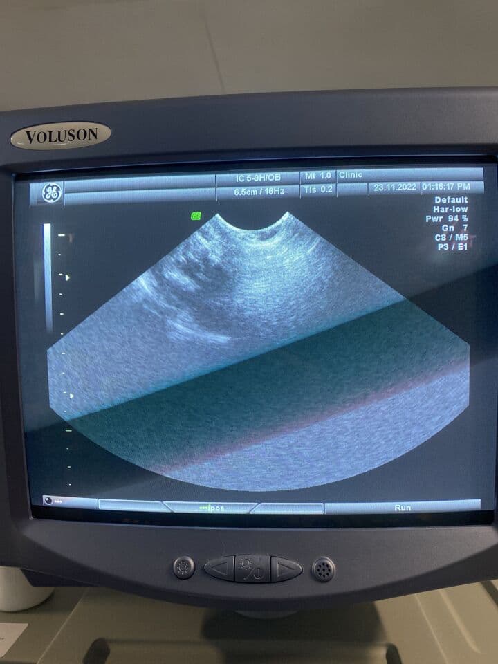 For Sale GE HEALTHCARE IC5-9H Ultrasound Transducer thumbnail 2