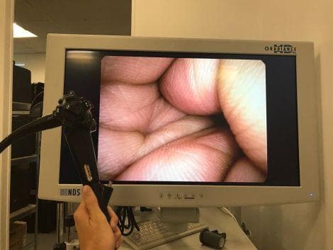 PENTAX EPK-i Video Processor and Xenon Light Source for Endoscopy thumbnail 5