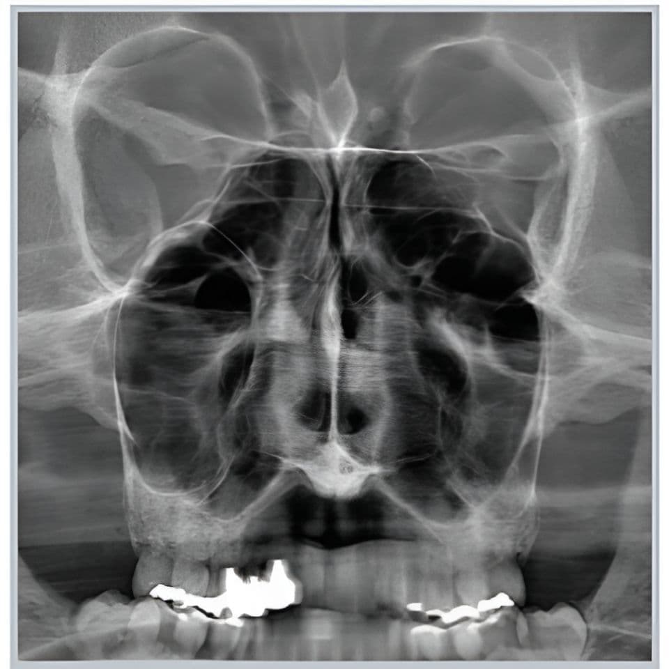 RAYSCAN Alpha Pan + CBCT (10x10 FOV) 3D Dental X-Ray System thumbnail 3