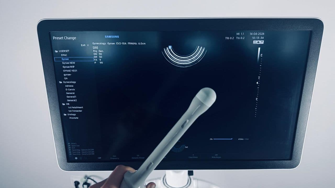 For Sale SAMSUNG HERA W10 2022 with 3 probes included ex demo OB / GYN Ultrasound thumbnail 5