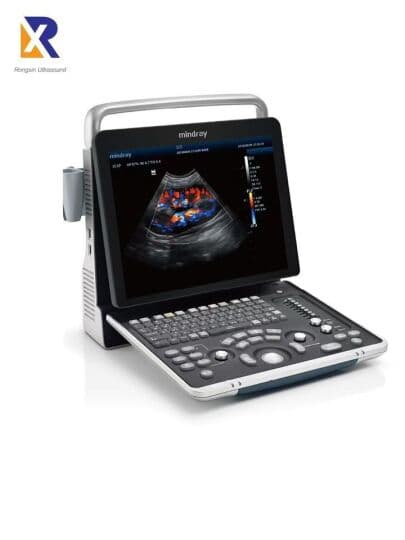 Mindray Z6T Portable Color Doppler Ultrasound System