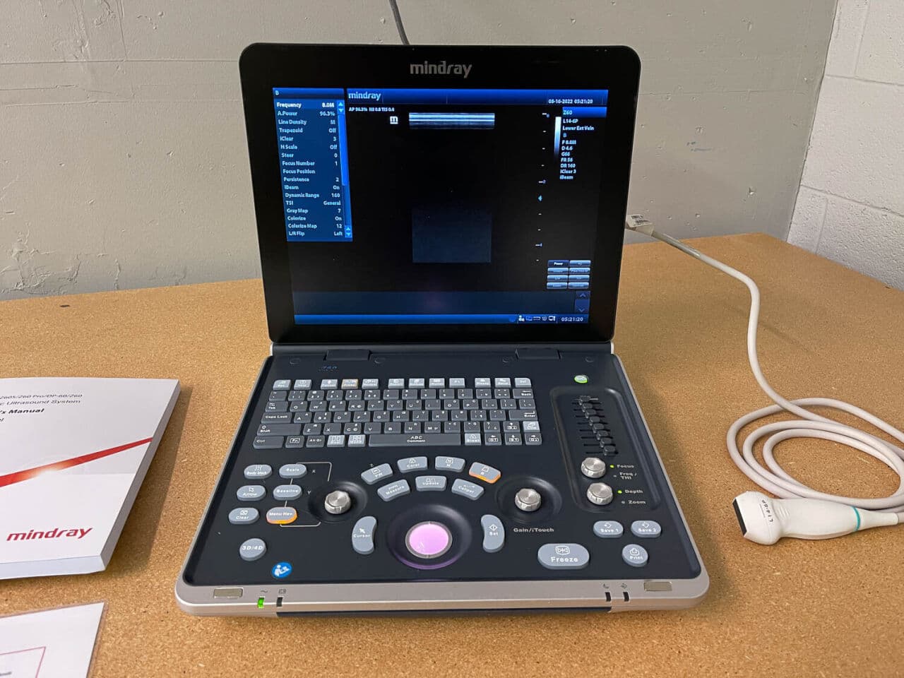 Mindray Z60 Ultrasound System for MSK and General Use image 1