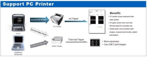 Portable B/W Ultrasound System — Chison ECO1 thumbnail 4