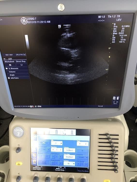 GE 7S Phased Array Sector Ultrasound Transducer thumbnail 2