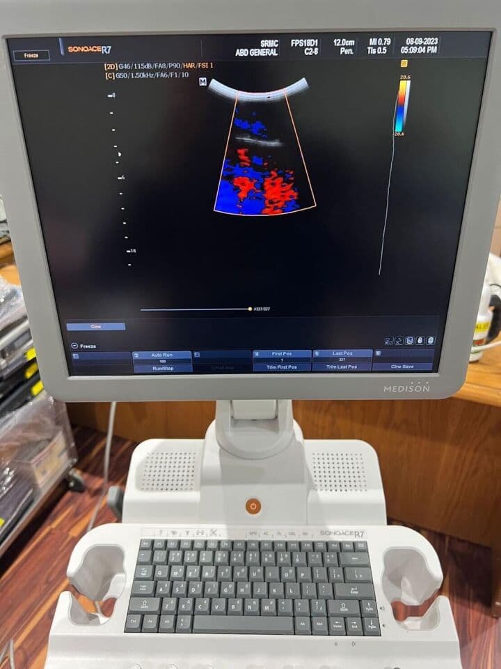 Samsung SonoAce 3D/4D OB/GYN Ultrasound System thumbnail 10