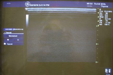 GE M12L Linear Matrix Array Ultrasound Transducer thumbnail 3