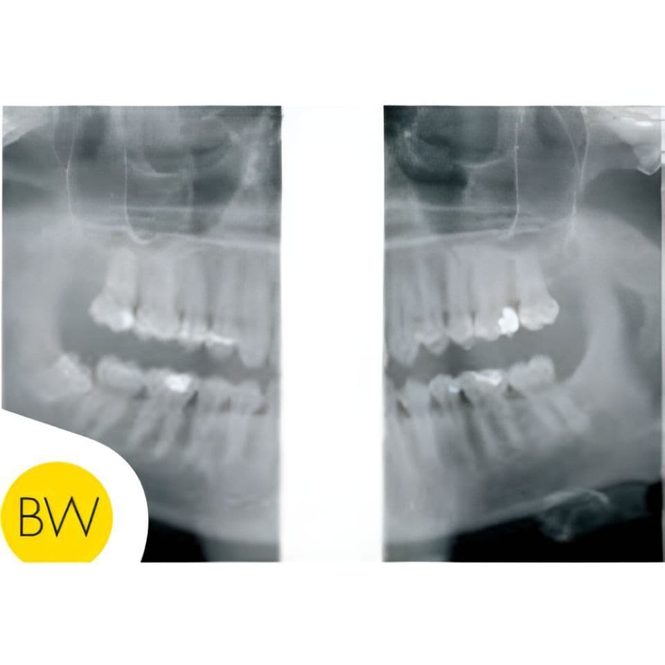 Instrumentarium OP30-2 Pan Digital Panoramic Dental X-Ray thumbnail 4