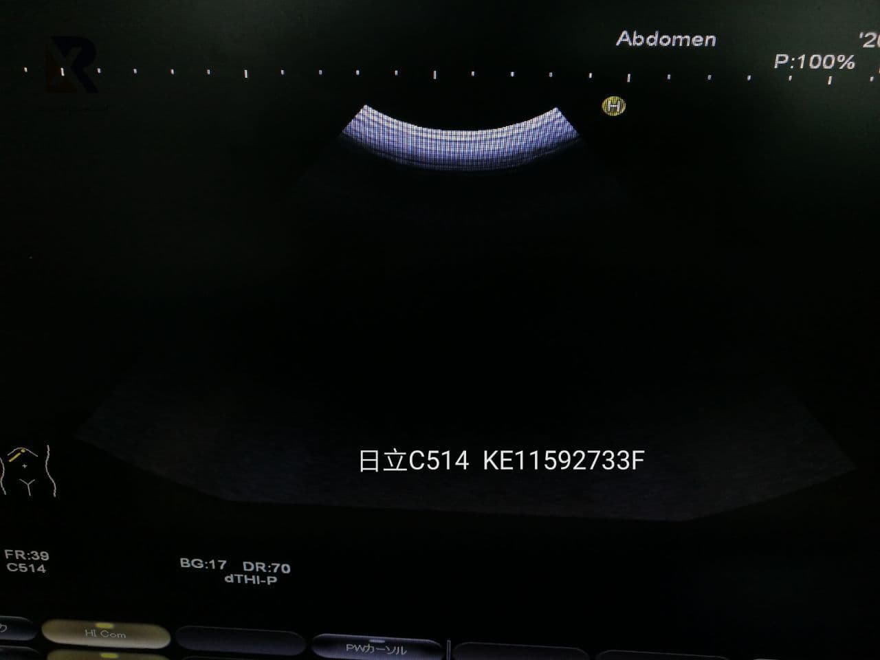 Hitachi EUP-C514 Curved Array Ultrasound Transducer thumbnail 4