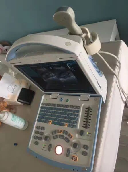 Mindray DP-10 Portable B/W Ultrasound Scanner with Convex Probe thumbnail 3
